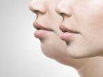 double-chin-1.jpg