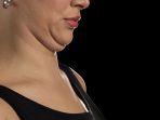 double-chin-6.jpg