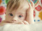 down-syndrome-2.jpg