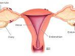endometriosis-1.jpg