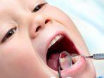 gingivitis-11.jpg