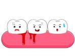 gingivitis-12.jpg