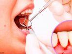 gingivitis-4.jpg