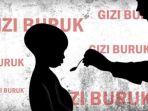 gizi-buruk.jpg