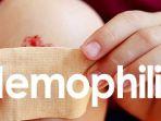 hemofilia-4.jpg