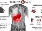 hepatitis-a-2.jpg