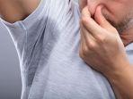 hiperhidrosis-3.jpg