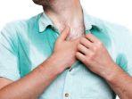 hiperhidrosis-8.jpg