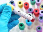 hiv-19.jpg