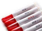 hiv-8.jpg