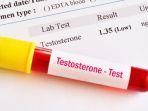 hormon-testosteron-1.jpg