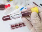 hormon-testosteron-2.jpg