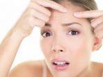 ilustrasi-acne-vulgaris-yang-menyebabkan-tingkat-kepercayaan-diri-menurun.jpg
