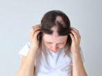 ilustrasi-alopecia-pada-anak.jpg