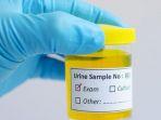 ilustrasi-analisis-urine.jpg