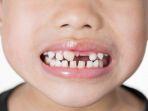 ilustrasi-baby-bottle-tooth-decay.jpg