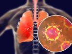 ilustrasi-bakteri-penyebab-tuberkulosis-begini-pemaparan.jpg
