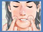 ilustrasi-bells-palsy.jpg
