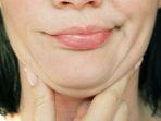 ilustrasi-double-chin-akibat-obesitas.jpg