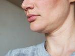 ilustrasi-double-chin-yang-bisa-diatasi-dengan-perawatan-kecantikan.jpg