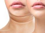 ilustrasi-double-chin.jpg