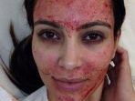 ilustrasi-facial-vampire.jpg