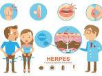 ilustrasi-herpes-genital-begini-pemaparan.jpg