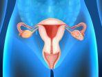 ilustrasi-kista-endometriosis-yang-dialami-sebagian-wanita.jpg