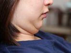ilustrasi-memiliki-double-chin.jpg