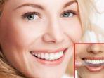 ilustrasi-memutihkan-gigi-dengan-whitening-strips.jpg