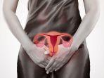 ilustrasi-mioma-uteri.jpg