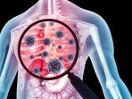 ilustrasi-pasien-tuberkulosis-tbc-begini-penuturan.jpg
