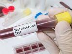 ilustrasi-pemeriksaan-kadar-testosteron.jpg