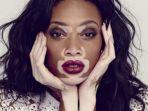 ilustrasi-penderita-vitiligo-yang-tetap-percaya-diri.jpg