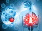 ilustrasi-pengidap-tuberkulosis-begini-pemaparan.jpg