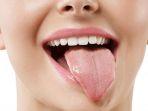 ilustrasi-penyakit-oral-trush.jpg