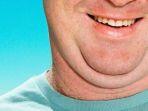 ilustrasi-pria-memiliki-double-chin.jpg