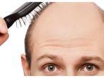 ilustrasi-pria-yang-mengalami-kerontokan-rambut.jpg