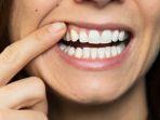 ilustrasi-resesi-gingiva.jpg
