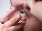 ilustrasi-softlens-yang-dipasangkan-pada-mata-begini-kata.jpg