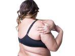 ilustrasi-stretch-mark-di-bahu.jpg