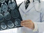 ilustrasi-stroke-menyerang-usia-muda-dibawah-45-tahun.jpg