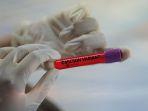 ilustrasi-virus-corona-varian-omicron.jpg