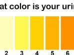 ilustrasi-warna-urine-yang-menggambarkan-kondisi-kesehatan.jpg