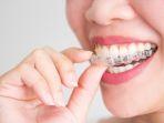 invisalign-2.jpg