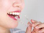 invisalign-3.jpg
