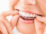 invisalign-6.jpg