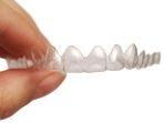 invisalign-7.jpg