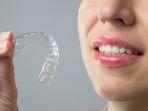 invisalign-8.jpg