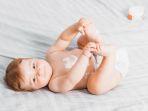 iritasi-kulit-bayi-8.jpg